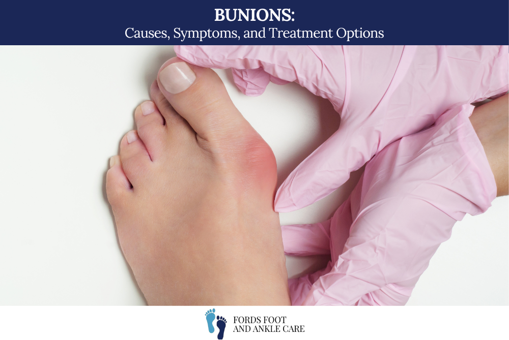 Bunions: Causes, Symptoms, and Treatment Options