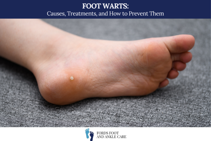 Foot Warts Causes, Treatments, and How to Prevent Them
