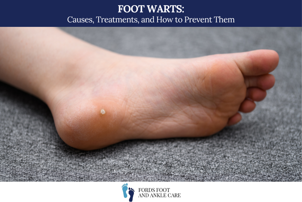 Foot Warts Causes, Treatments, and How to Prevent Them