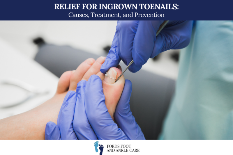 Relief for Ingrown Toenails: Causes, Treatment, and Prevention