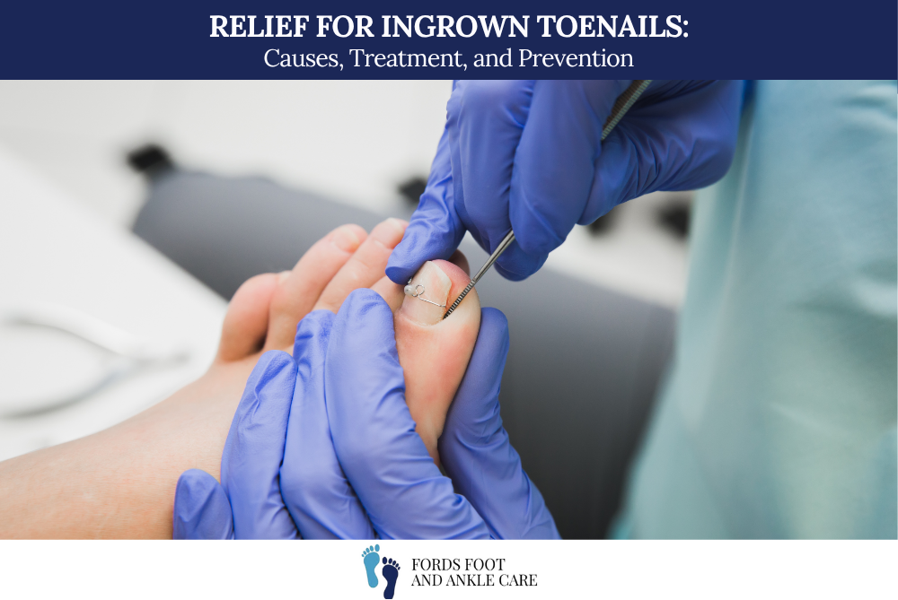 Relief for Ingrown Toenails: Causes, Treatment, and Prevention